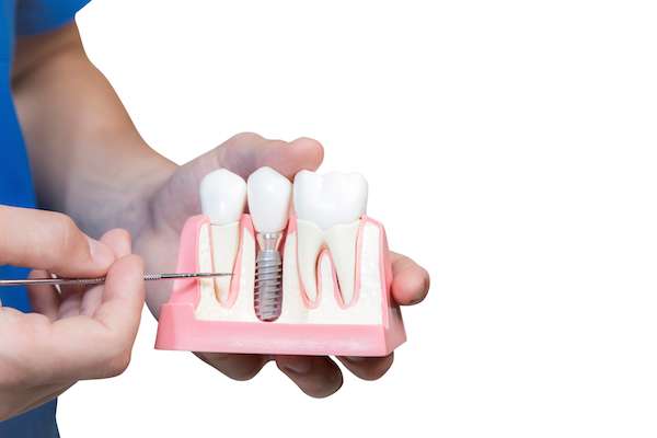 Can You Get Dental Implants if You Have Gum Disease from Heather Feray Bohan, DDS, PA in Tomball, TX