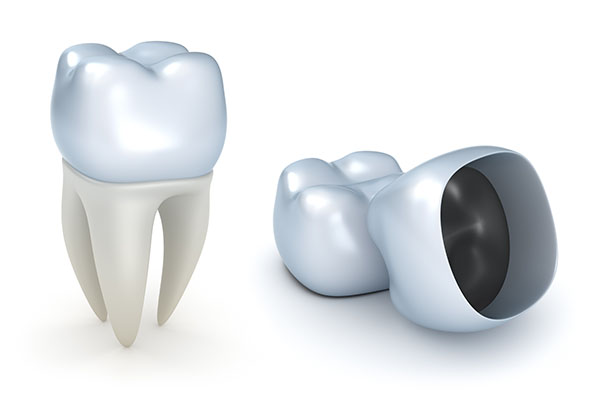 Is a Dental Crown Recommended for Dealing with a Cracked Tooth? from Heather Feray Bohan, DDS, PA in Tomball, TX