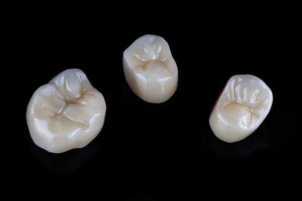 A Comparison of Dental Crown Materials from Heather Feray Bohan, DDS, PA in Tomball, TX