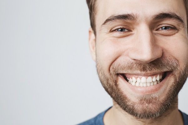 What Can Dental Veneers Help Fix?