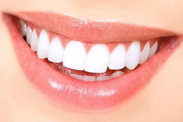 How Long Does Teeth Whitening Take from Heather Feray Bohan, DDS, PA in Tomball, TX