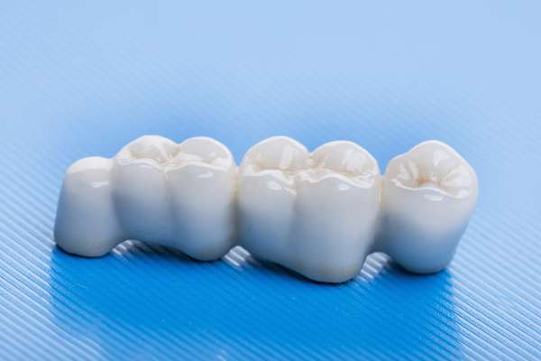 How Many Teeth Can Dental Bridges Replace from Heather Feray Bohan, DDS, PA in Tomball, TX