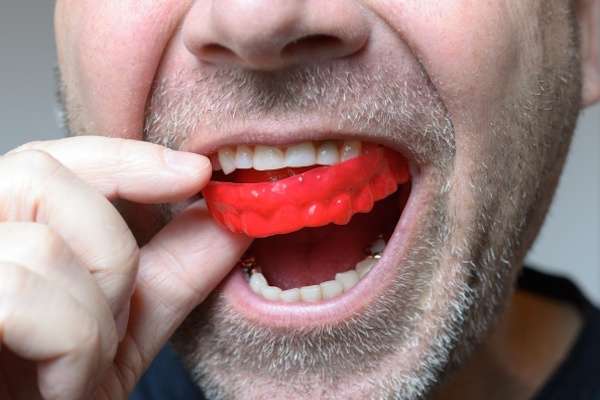 Save Your Teeth by Wearing Mouth Guards at Night from Heather Feray Bohan, DDS, PA in Tomball, TX