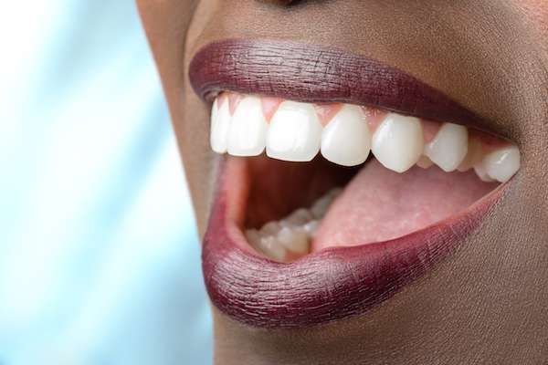 Routine Dental Care: What Are Tooth Colored Fillings from Heather Feray Bohan, DDS, PA in Tomball, TX